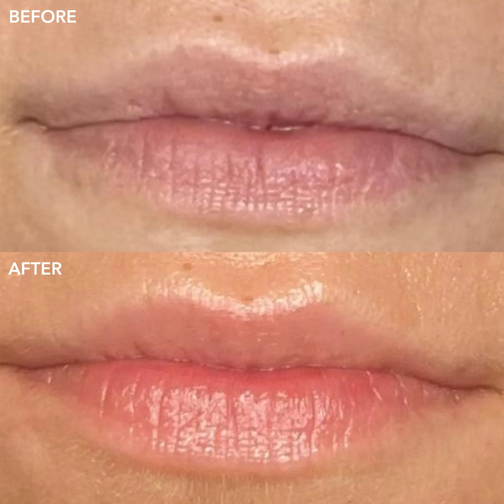GENIUS Liquid Collagen® Lip